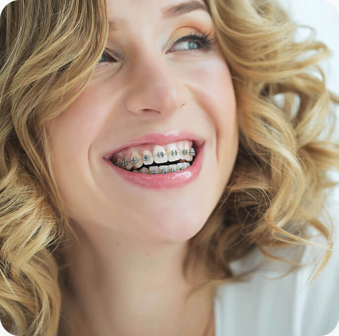 dental braces Oakleigh south