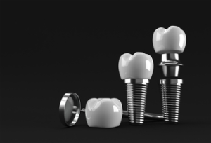 Check bnsMelbournedentalimplant.com.au